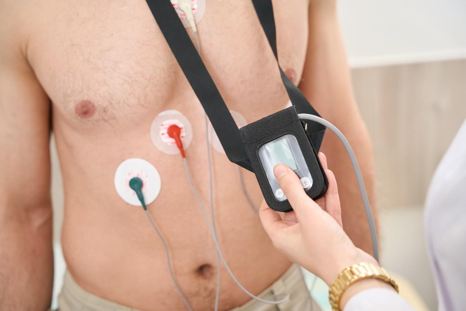 Cardiologist monitoring